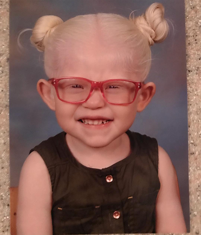 Mexican-American Parents Are Shocked After Giving Birth To A Blond Baby Girl With Light Skin