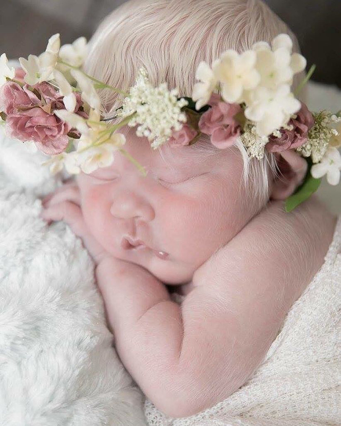 Mexican-American Parents Are Shocked After Giving Birth To A Blond Baby Girl With Light Skin