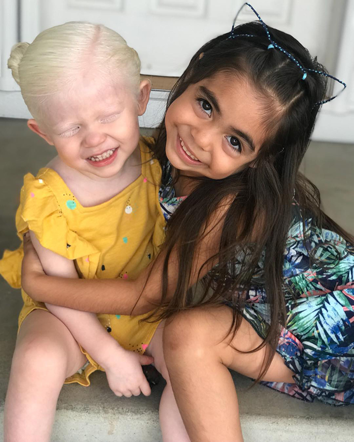 Mexican-American Parents Are Shocked After Giving Birth To A Blond Baby Girl With Light Skin