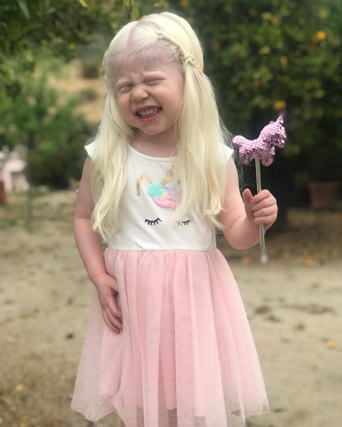 Mexican-American Parents Are Shocked After Giving Birth To A Blond Baby Girl With Light Skin