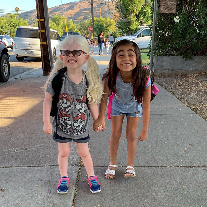 Mexican-American Parents Are Shocked After Giving Birth To A Blond Baby Girl With Light Skin