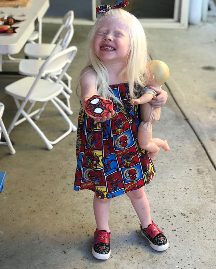 Mexican-American Parents Are Shocked After Giving Birth To A Blond Baby Girl With Light Skin