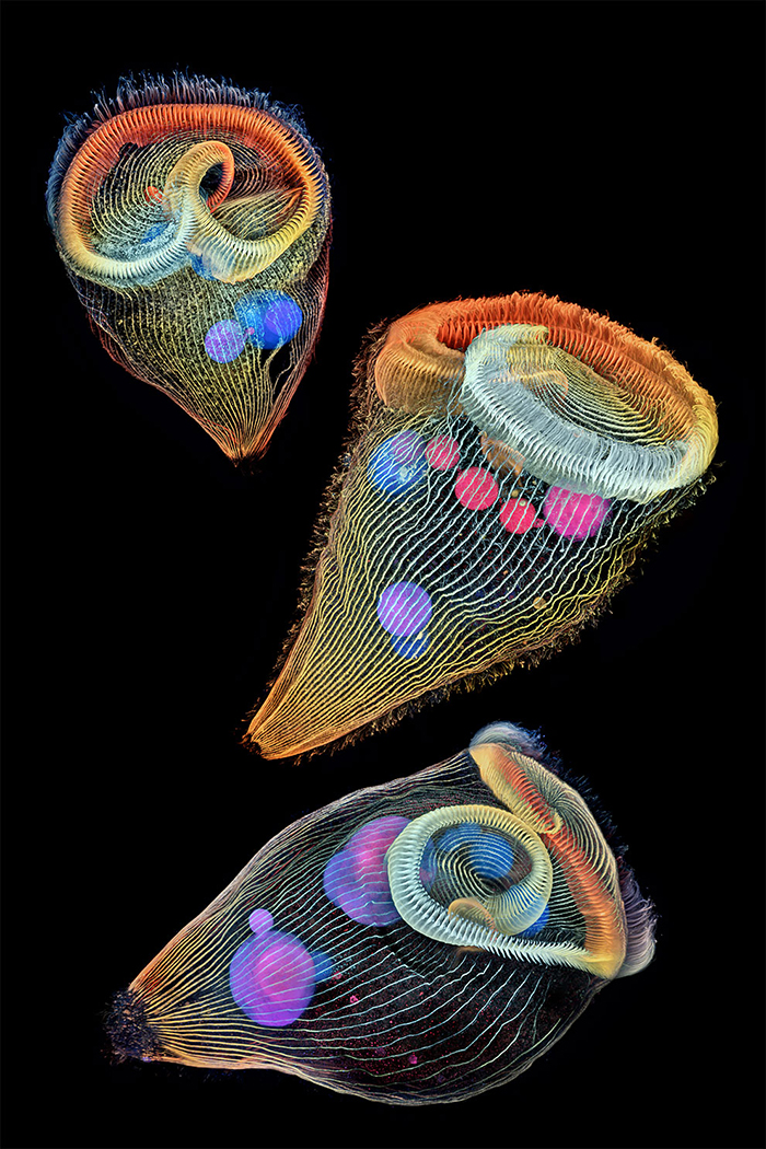Depth-Color Coded Projections Of Three Stentors (Single-Cell Freshwater Protozoans)