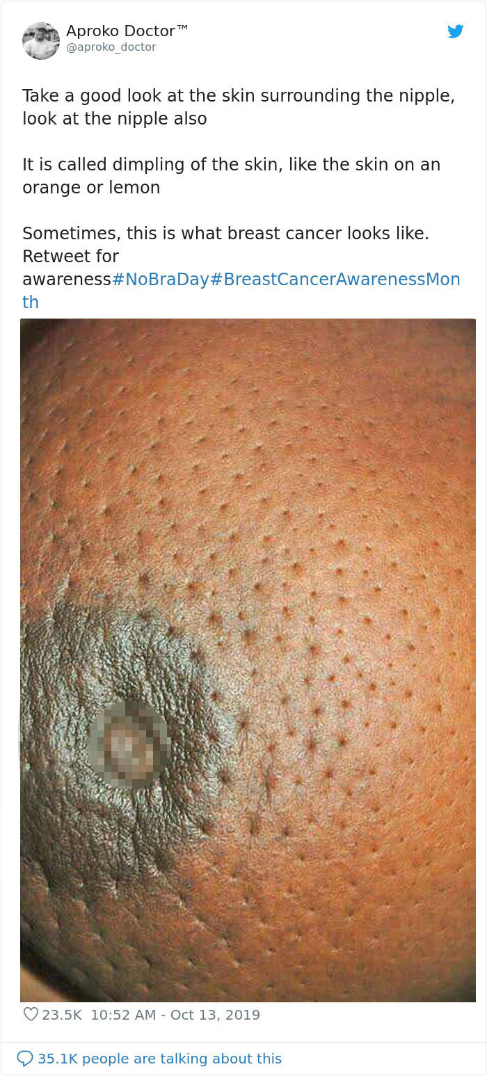 No-Bra-Day-Tweets-Raising-Awareness