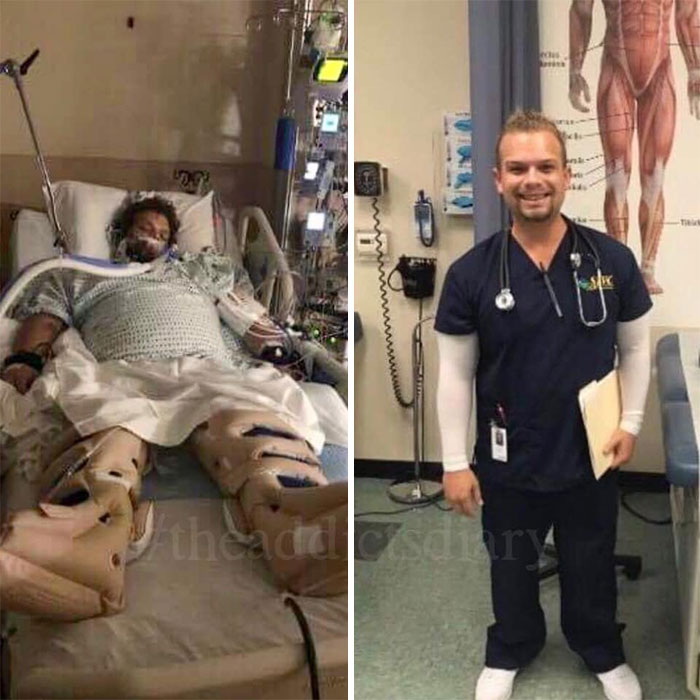 Addicts-Diary-Before-After-Photo