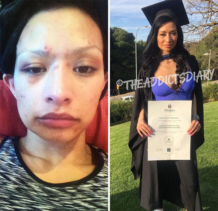 Addicts-Diary-Before-After-Photo