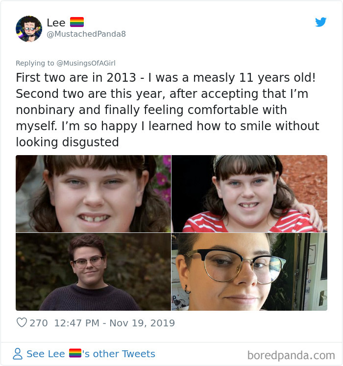 People-Decade-Transformation-Before-After-Photo