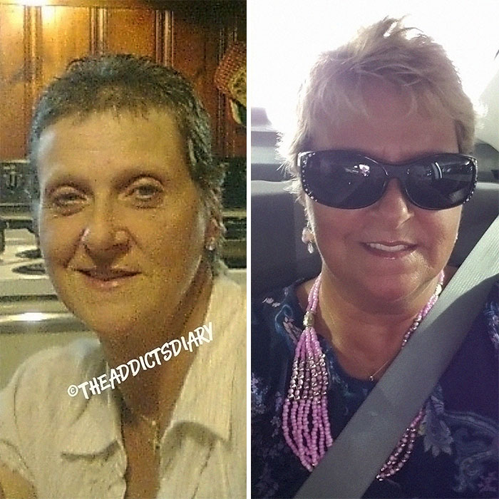Addicts-Diary-Before-After-Photo