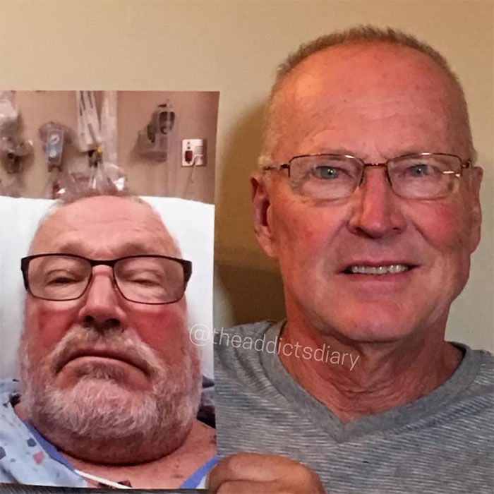 Addicts-Diary-Before-After-Photo