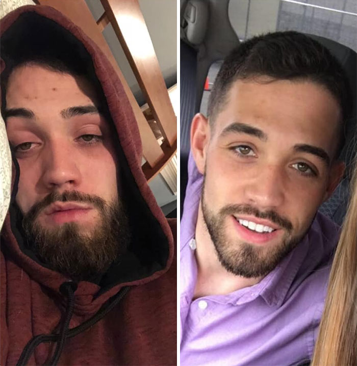 Addicts-Diary-Before-After-Photo