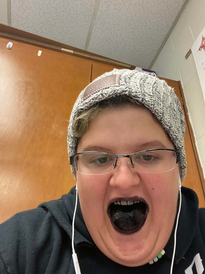 My Pen Exploded In My Mouth. I Have A Senior Speech For Marching Band Today