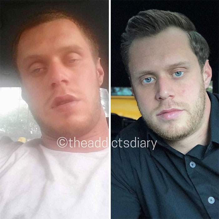 Addicts-Diary-Before-After-Photo