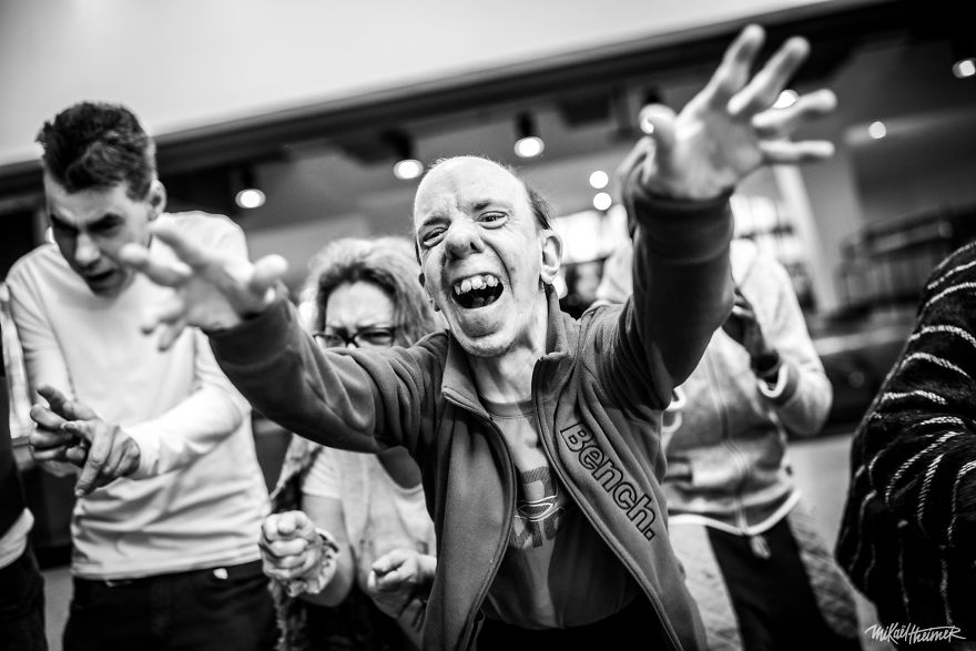 These Artists Proved That In Art, Disability Is Not A Thing