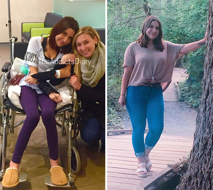 Addicts-Diary-Before-After-Photo