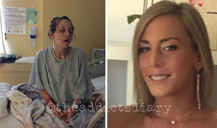 Addicts-Diary-Before-After-Photo