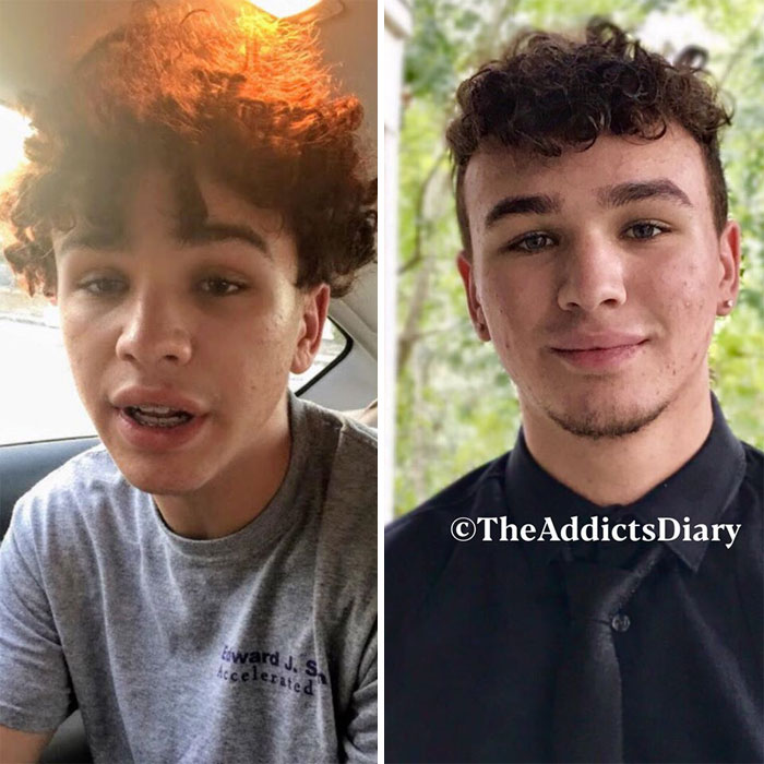 Addicts-Diary-Before-After-Photo
