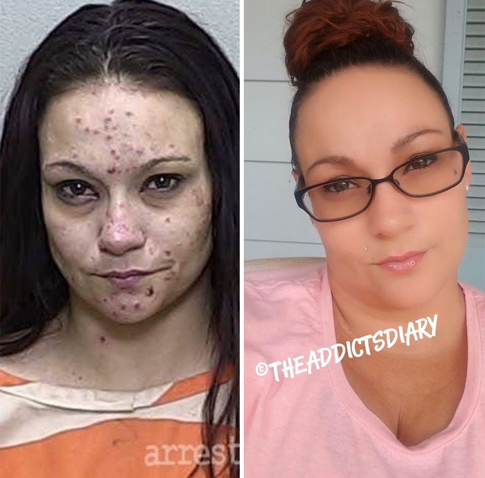 Addicts-Diary-Before-After-Photo