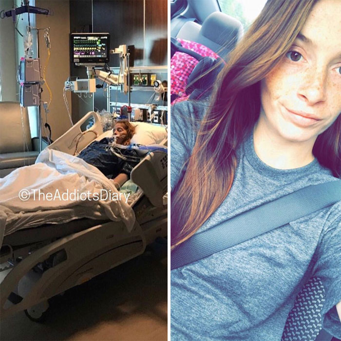 Addicts-Diary-Before-After-Photo