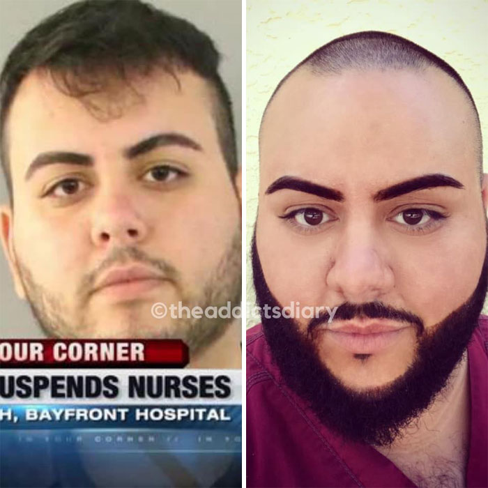 Addicts-Diary-Before-After-Photo