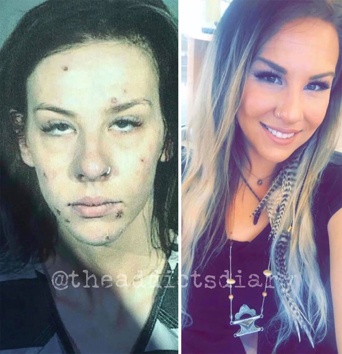 Addicts-Diary-Before-After-Photo