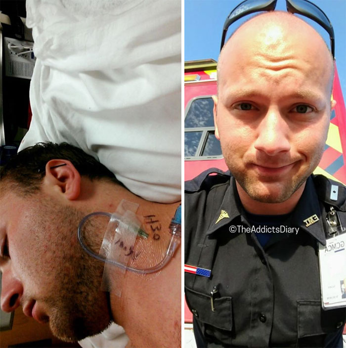 Addicts-Diary-Before-After-Photo