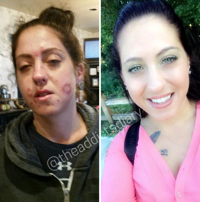 Addicts-Diary-Before-After-Photo