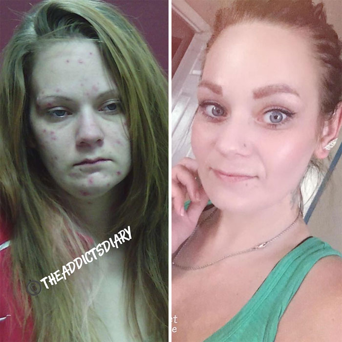 Addicts-Diary-Before-After-Photo