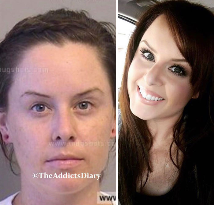 Addicts-Diary-Before-After-Photo