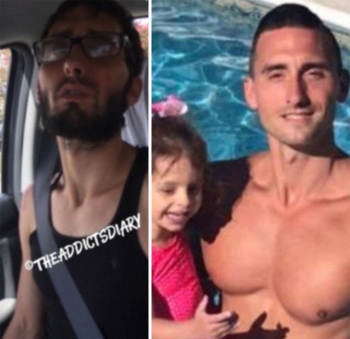 Addicts-Diary-Before-After-Photo