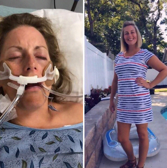 Addicts-Diary-Before-After-Photo