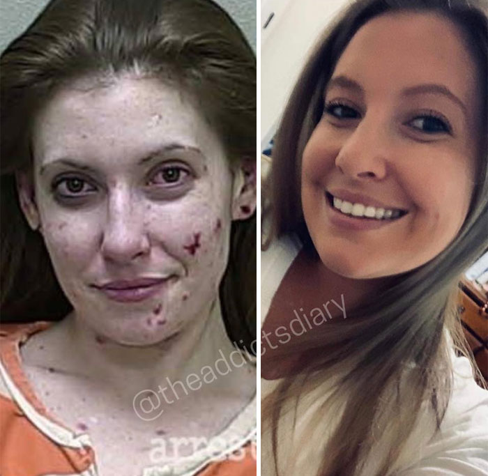 Addicts-Diary-Before-After-Photo
