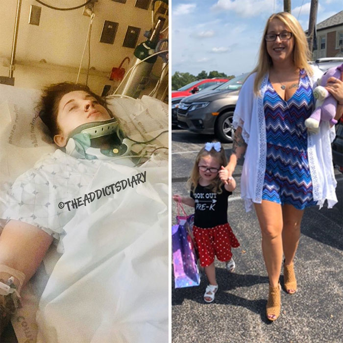 Addicts-Diary-Before-After-Photo