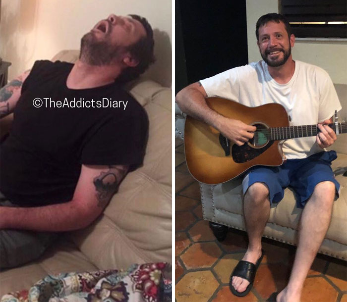Addicts-Diary-Before-After-Photo