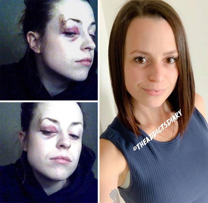 Addicts-Diary-Before-After-Photo