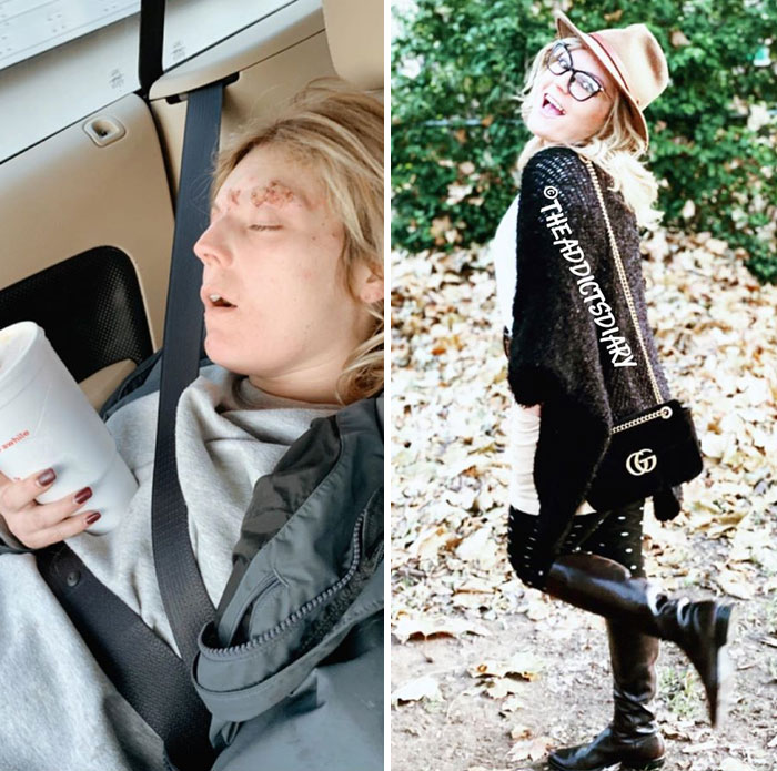 Addicts-Diary-Before-After-Photo