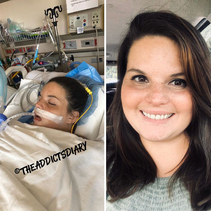 Addicts-Diary-Before-After-Photo