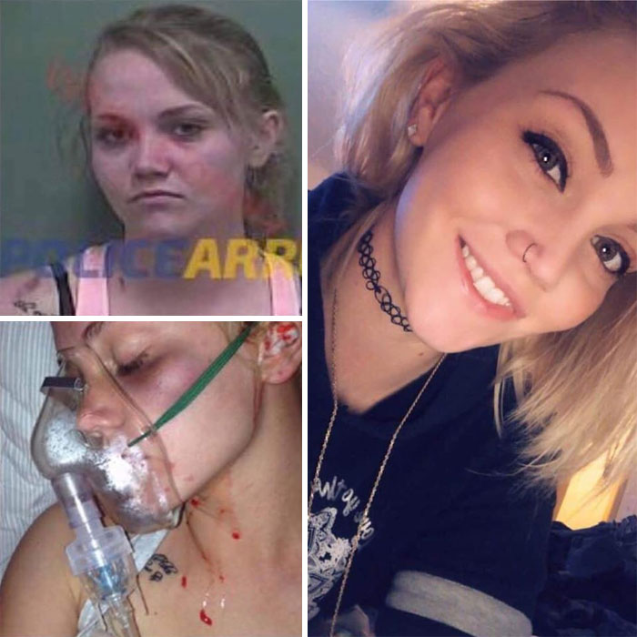 Addicts-Diary-Before-After-Photo