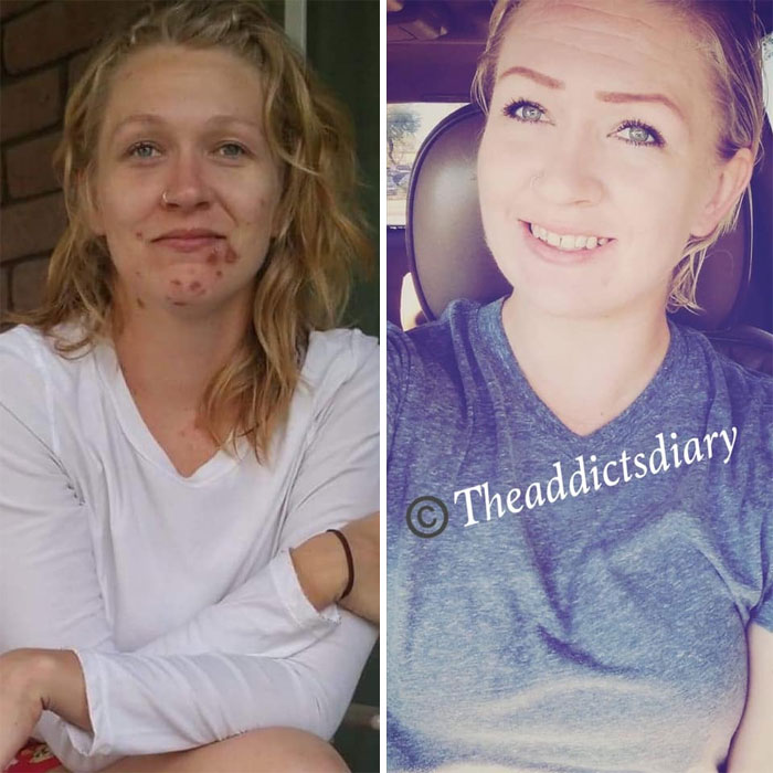 Addicts-Diary-Before-After-Photo