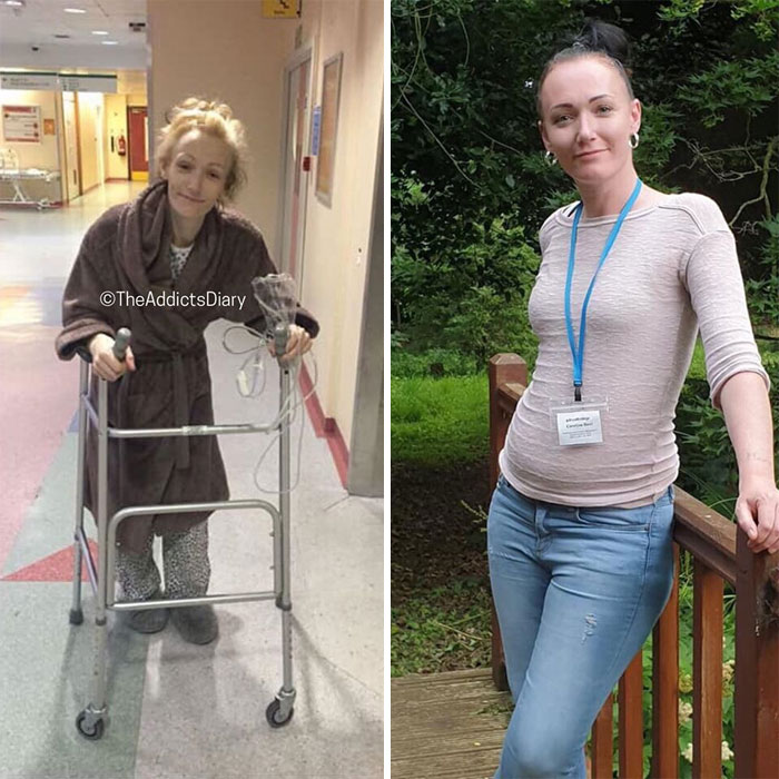 Addicts-Diary-Before-After-Photo