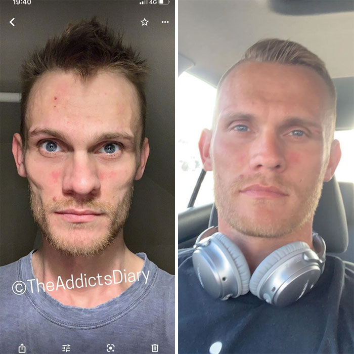 Addicts-Diary-Before-After-Photo