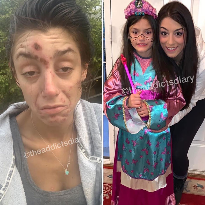 Addicts-Diary-Before-After-Photo