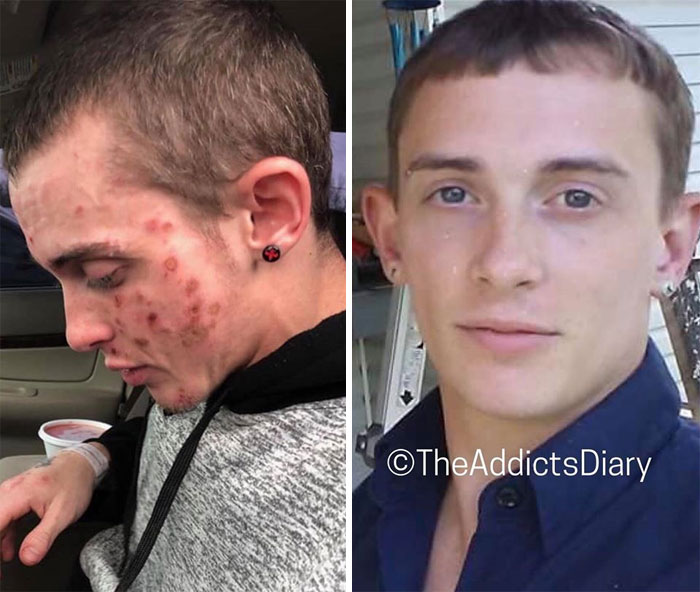 Addicts-Diary-Before-After-Photo