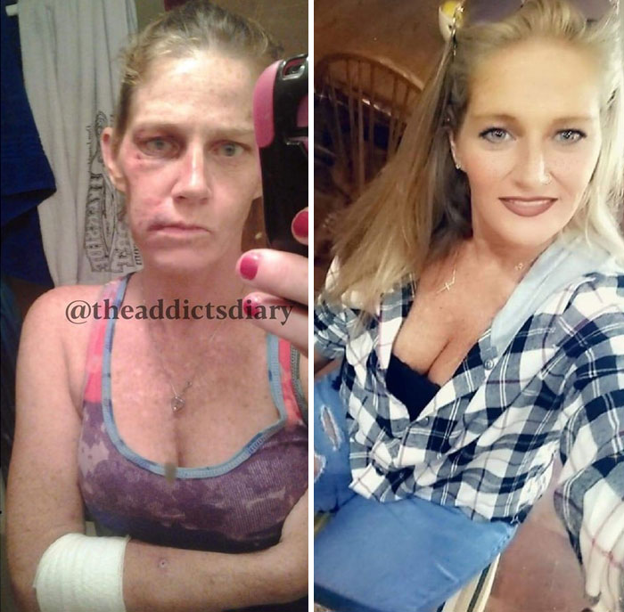 Addicts-Diary-Before-After-Photo