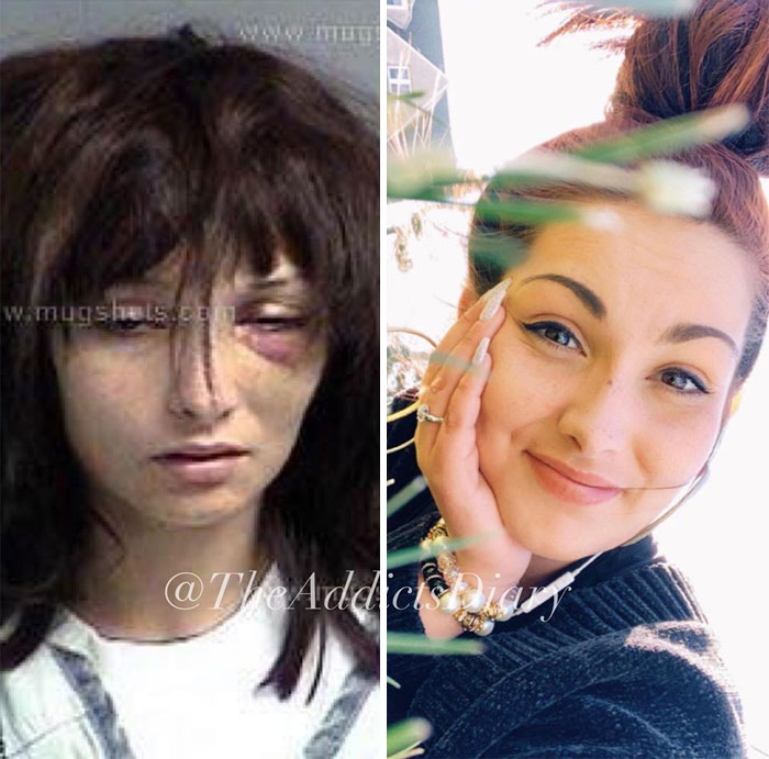 Addicts-Diary-Before-After-Photo