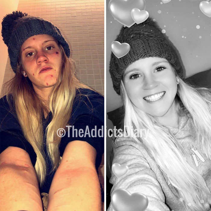 Addicts-Diary-Before-After-Photo