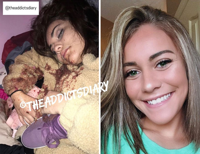 Addicts-Diary-Before-After-Photo