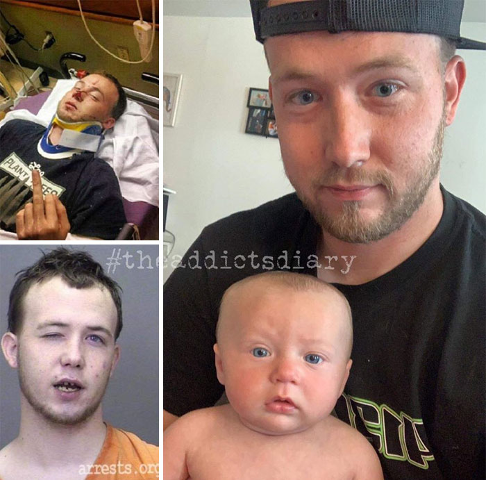 Addicts-Diary-Before-After-Photo