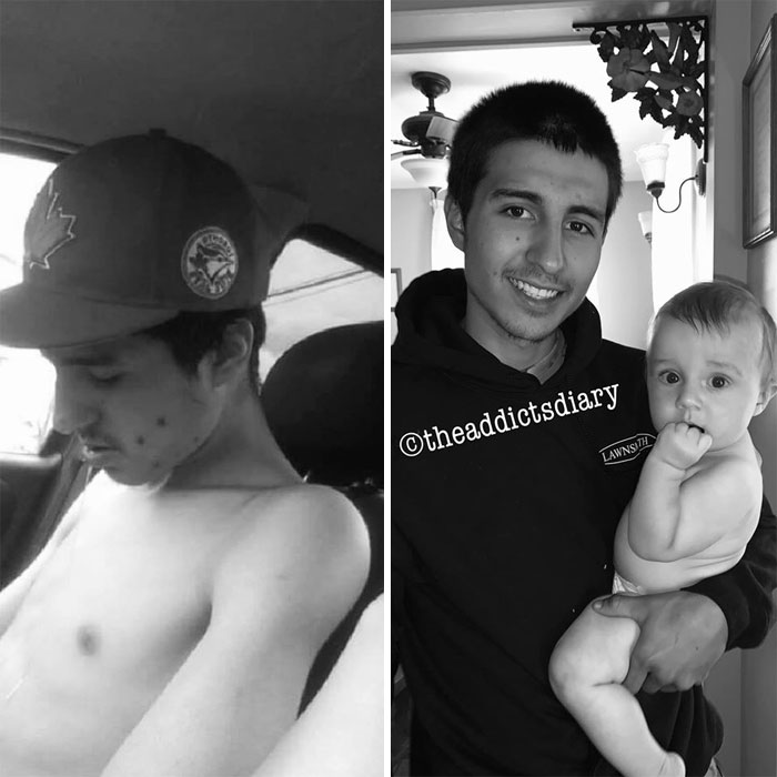 Addicts-Diary-Before-After-Photo