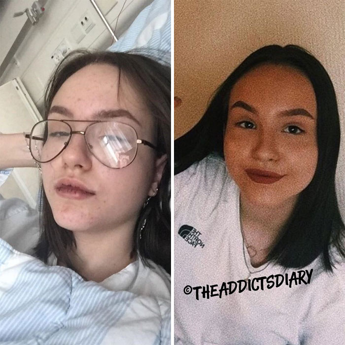 Addicts-Diary-Before-After-Photo