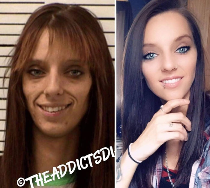 Addicts-Diary-Before-After-Photo